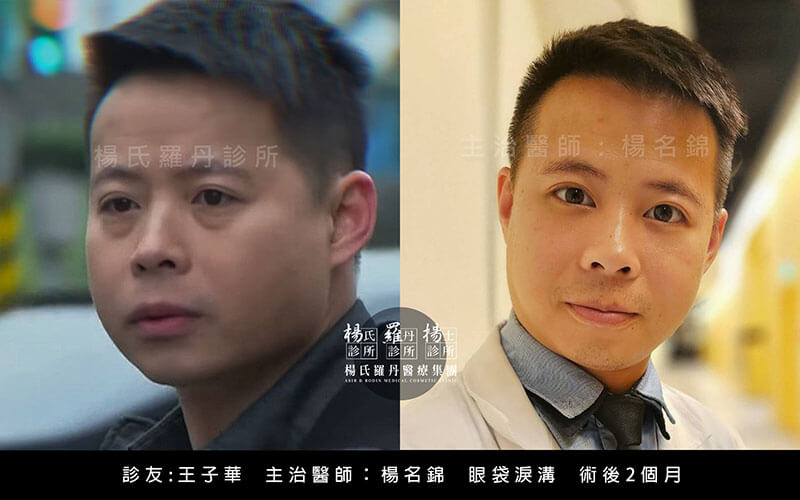 醫美微整形案例分享