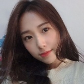 割縫雙眼皮手術案例心得分享