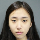 割縫雙眼皮手術案例心得分享