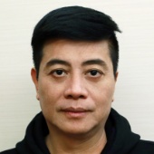 消除淚溝填補淚溝手術案例心得分享