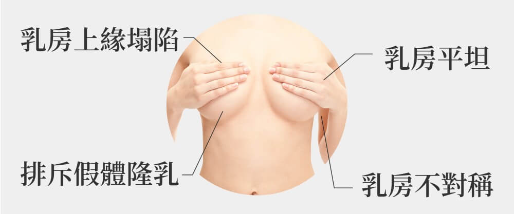 自體脂肪隆乳適合對象