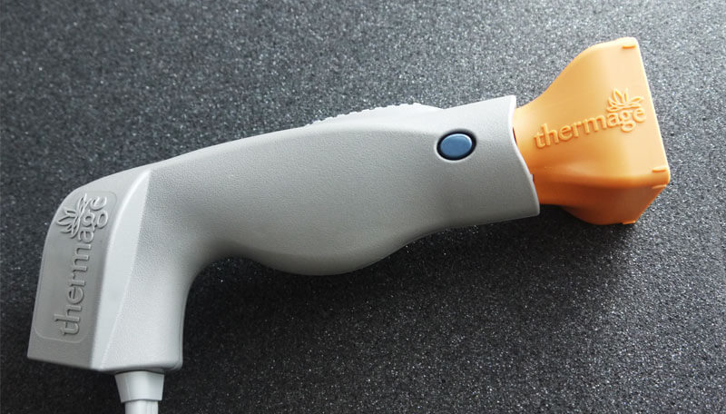 電波拉皮,拉皮緊緻,改善細紋