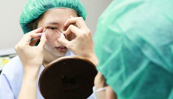 雙眼皮手術,割雙眼皮,縫雙眼皮