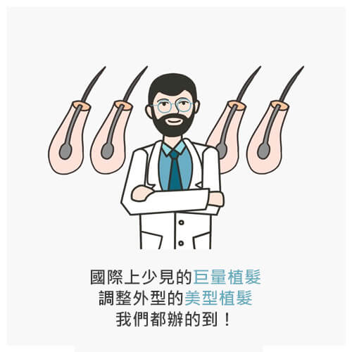 植髮,FUE,寇約翰髮,大量植髮