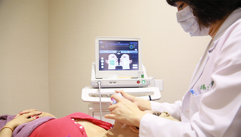 音波拉提,音波拉皮,臉部拉提,Ulthera