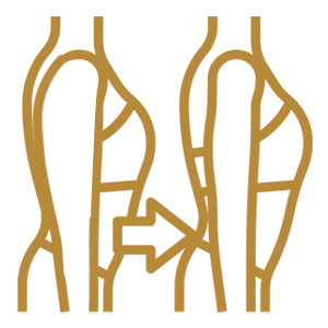 雷射減脂案例BA照