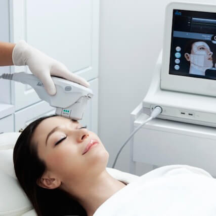 音波拉提,音波拉皮,臉部拉提