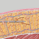 體雕,減脂,雷射減脂,超音波抽脂