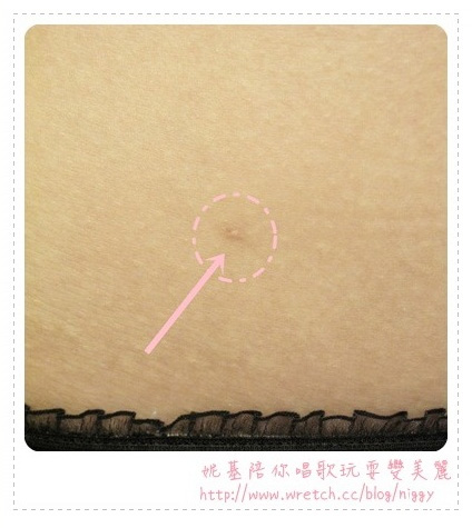 雷射減脂 減脂