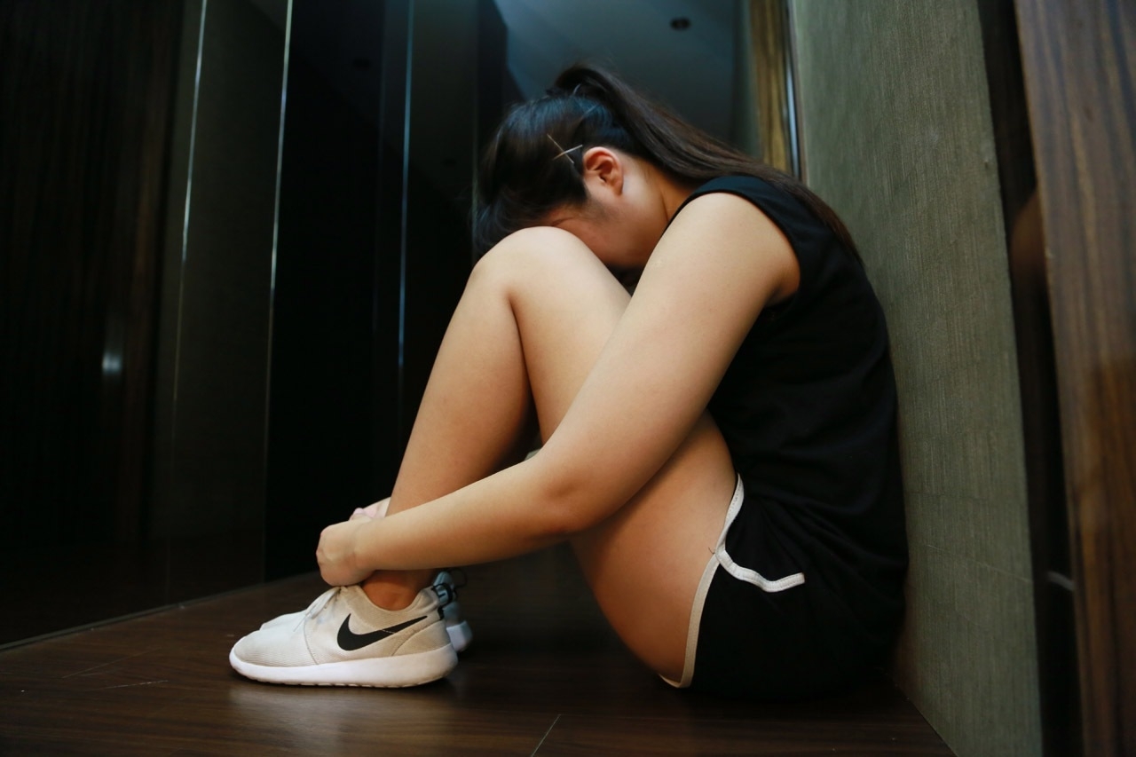 台北手臂抽脂瘦手臂術前