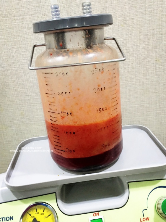 抽脂