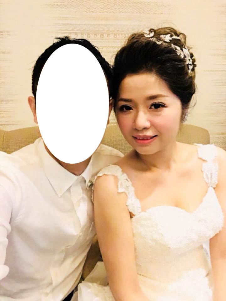 雷射減脂,消脂,體雕,瘦手臂