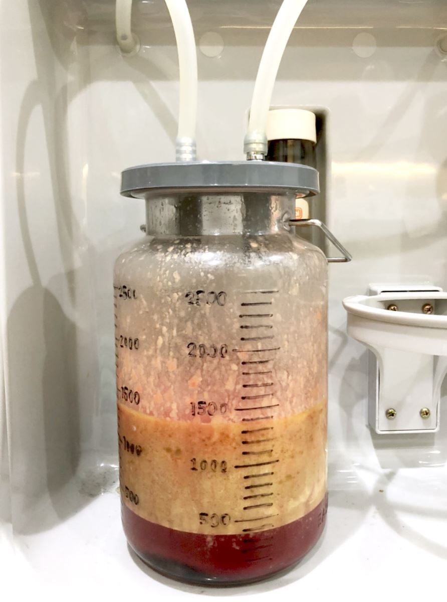 台北,雷射減脂瘦手臂,手臂抽脂,賴斯敏醫師 台北,雷射減脂瘦手臂,手臂抽脂,賴斯敏醫師