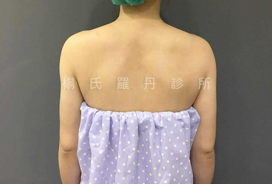 案例分享