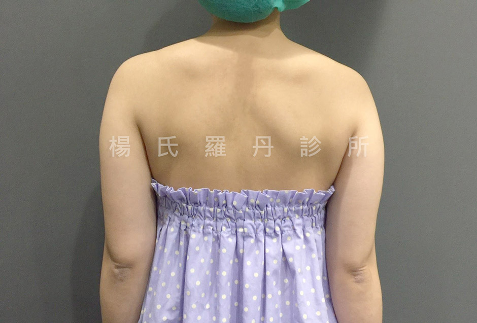 案例分享