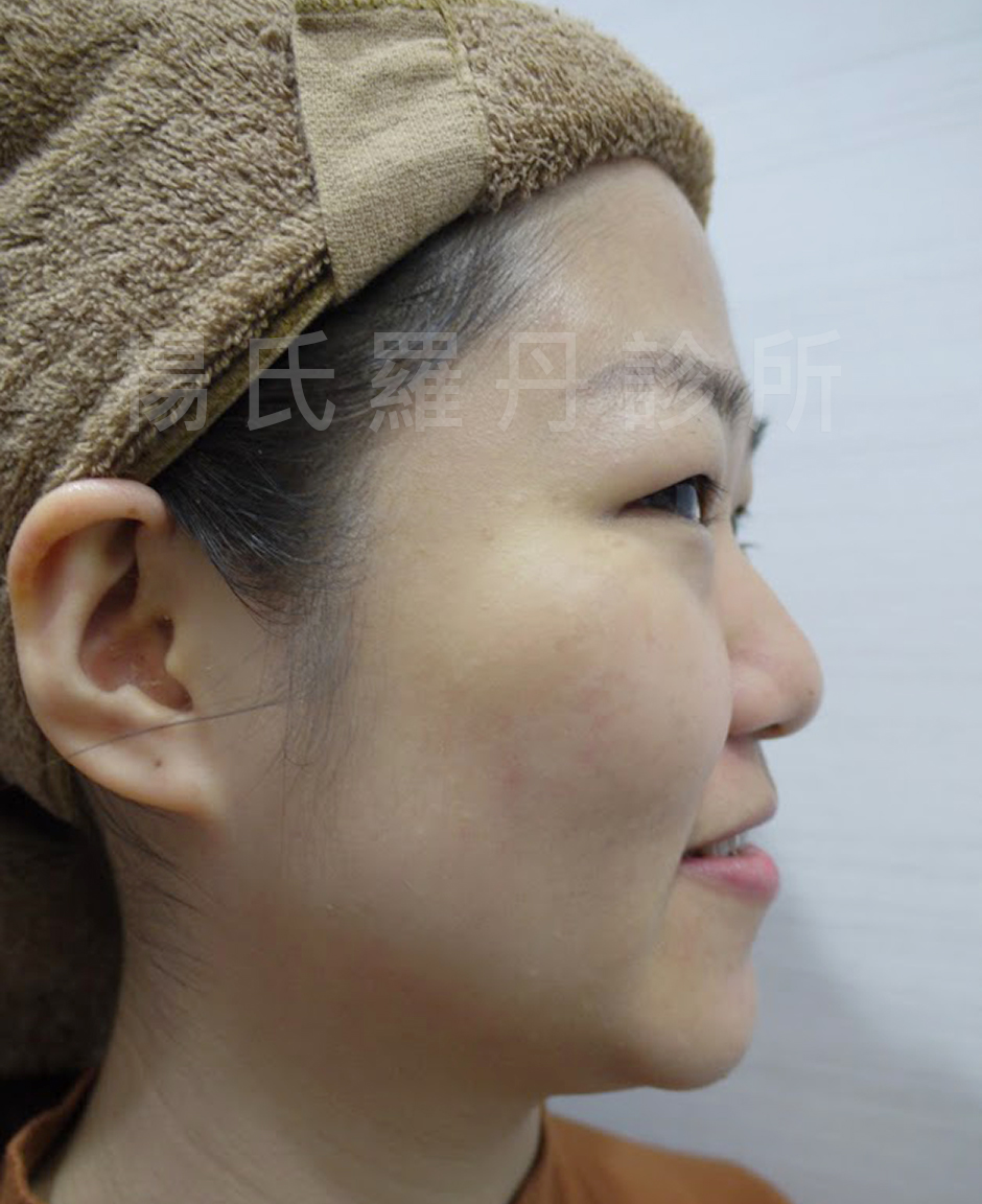 楊名錦,楊氏醫學美容