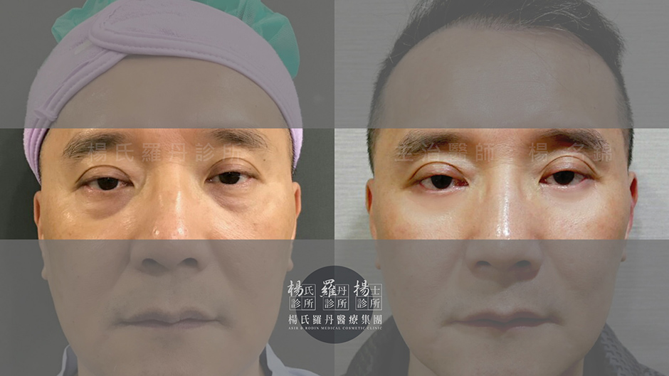 楊名錦