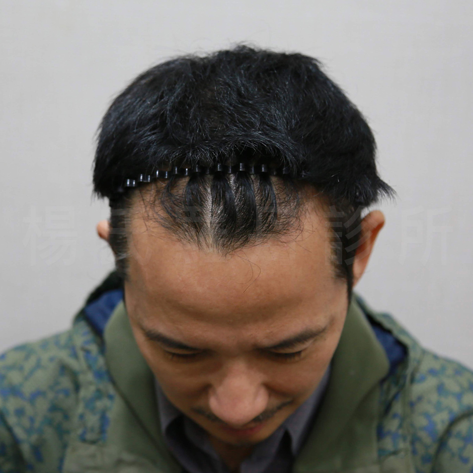 楊名權