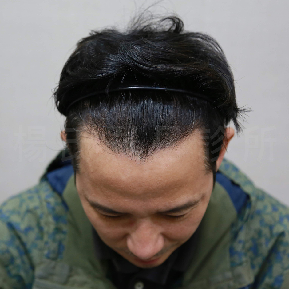 楊名權