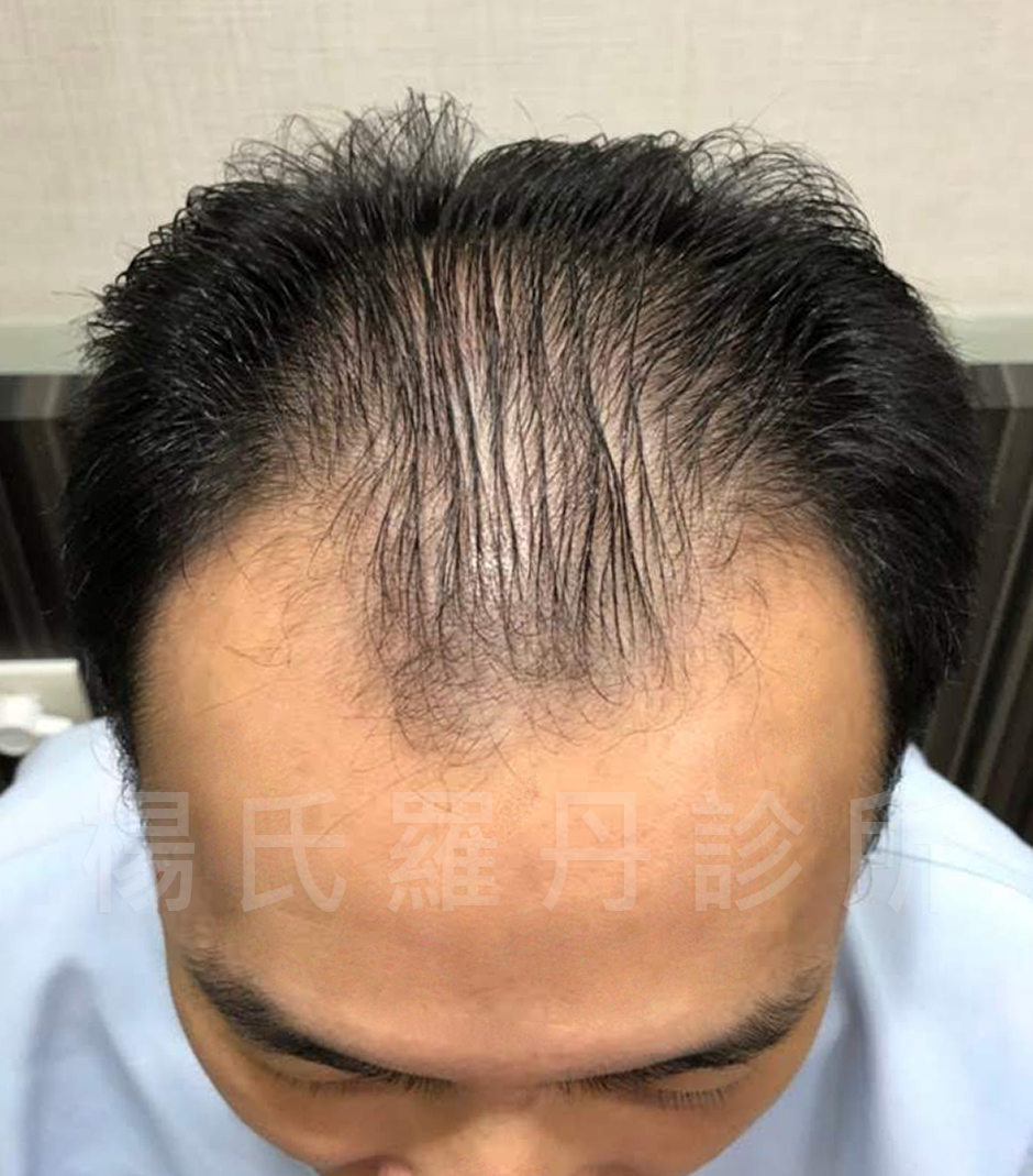 案例分享