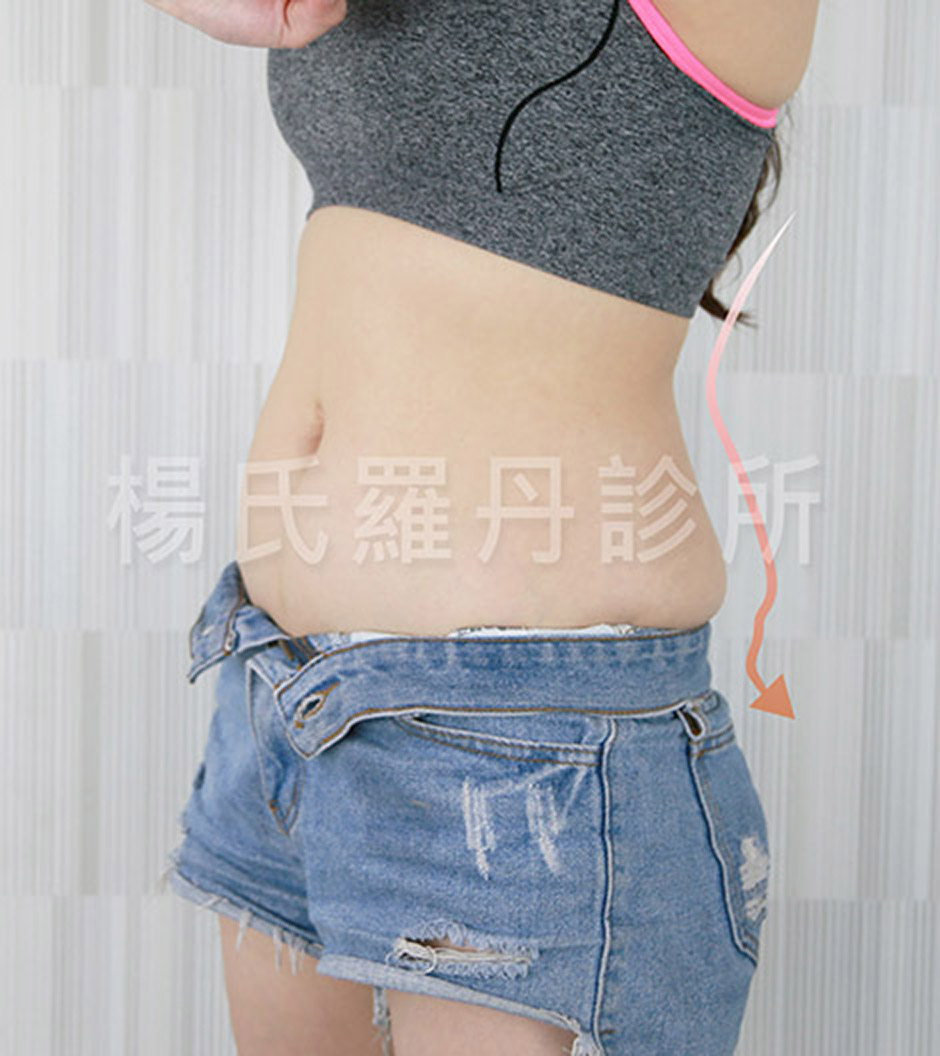 案例分享