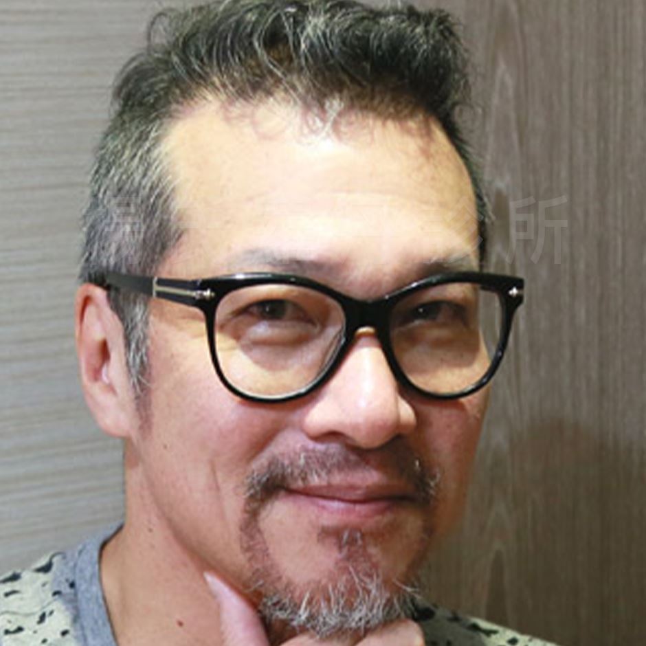 植髮,雄性禿,楊氏羅丹,台北植髮,植鬍,植眉,圓禿,掉髮,落髮,楊名權,李定懋