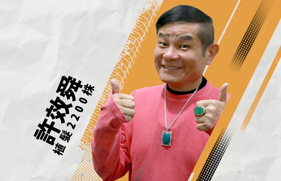 植髮,雄性禿,楊氏羅丹,台北植髮,植鬍,植眉,圓禿,掉髮,落髮,楊名權,李定懋