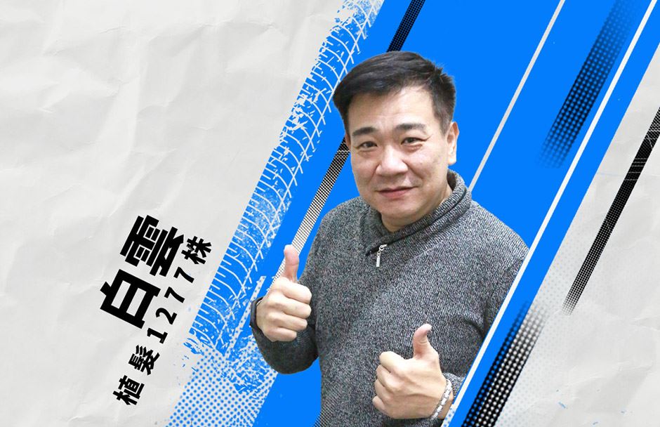 植髮,雄性禿,楊氏羅丹,台北植髮,植鬍,植眉,圓禿,掉髮,落髮,楊名權,李定懋