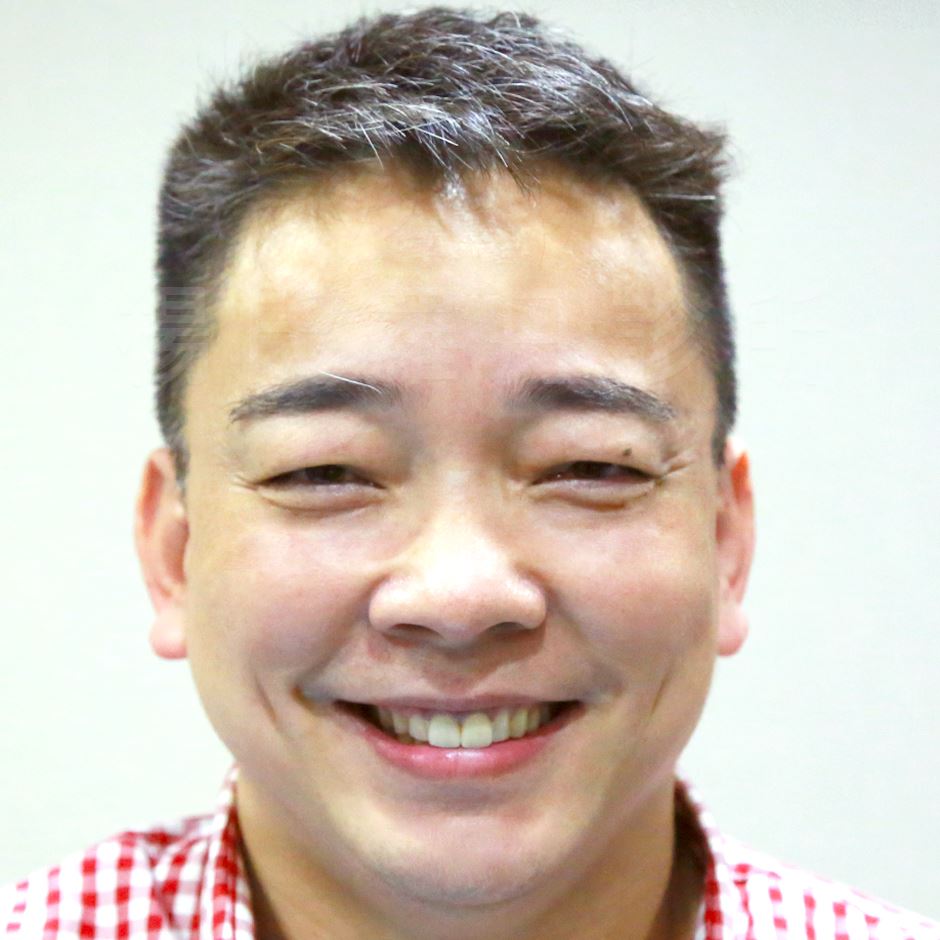 雄性禿,楊氏羅丹,台北植髮,植鬍,植眉,圓禿,掉髮,落髮,楊名權