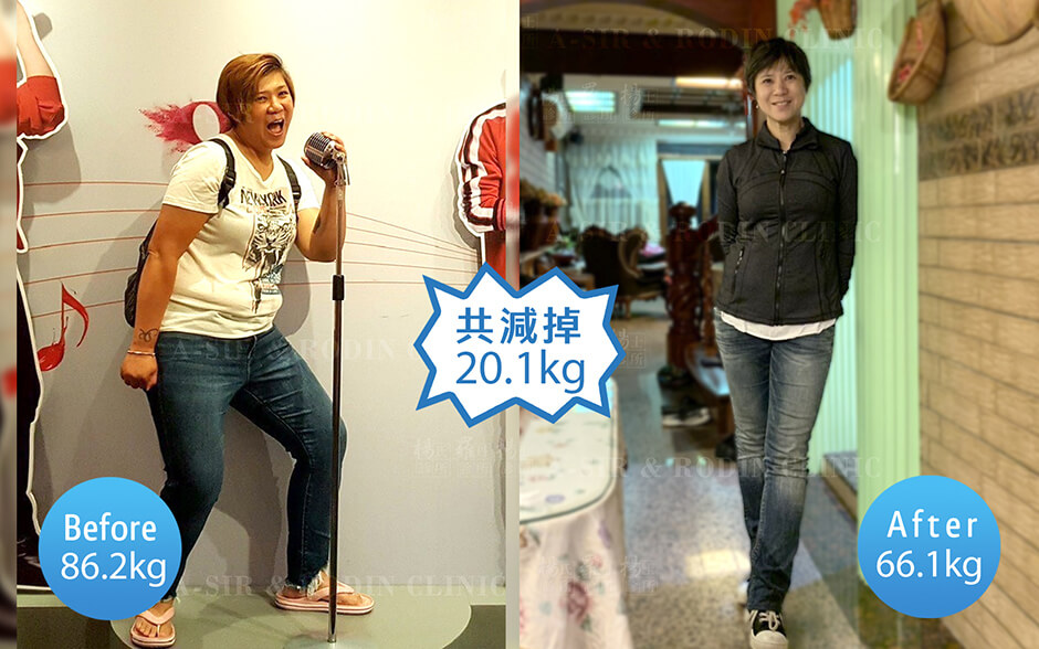 減肥減重,減肥門診,減重門診,雷永兆,楊氏羅丹,楊氏診所,台北減重,台北減肥,塑身,體態,身材