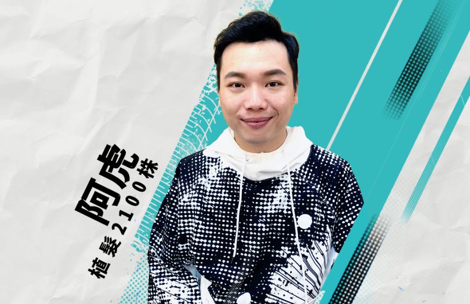 植髮,雄性禿,楊氏羅丹,台北植髮,植鬍,植眉,掉髮,落髮,楊名權,李定懋