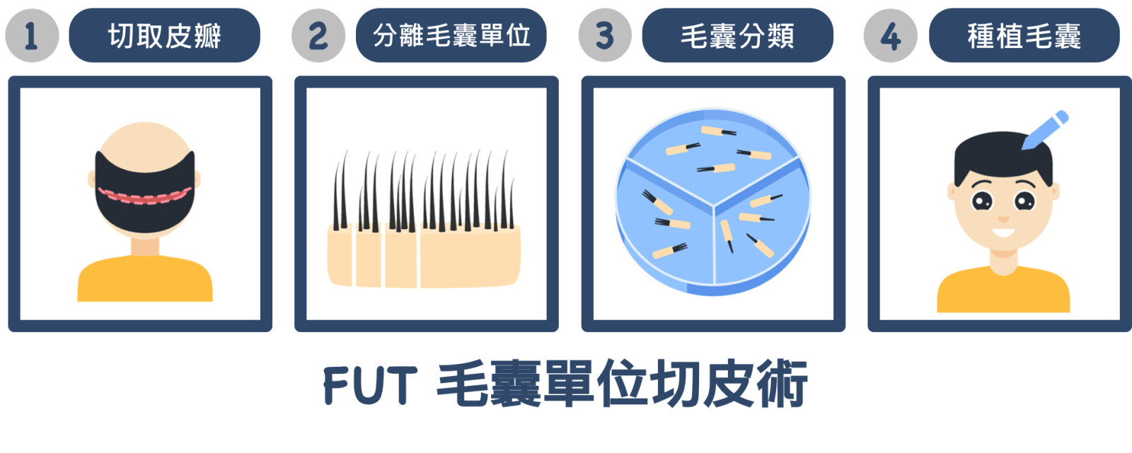 FUT植髮手術過程
