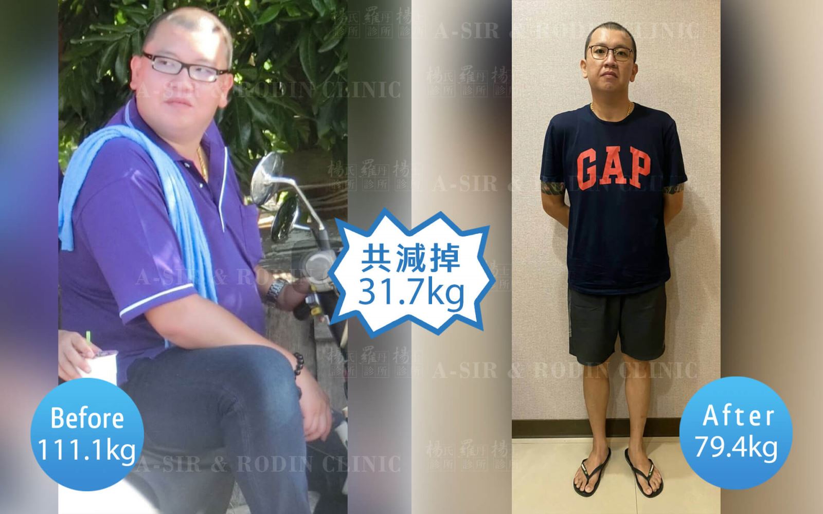 改善肥胖 減肥成功 瘦身