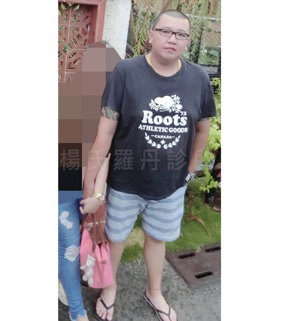 改善肥胖 瘦身 減肥