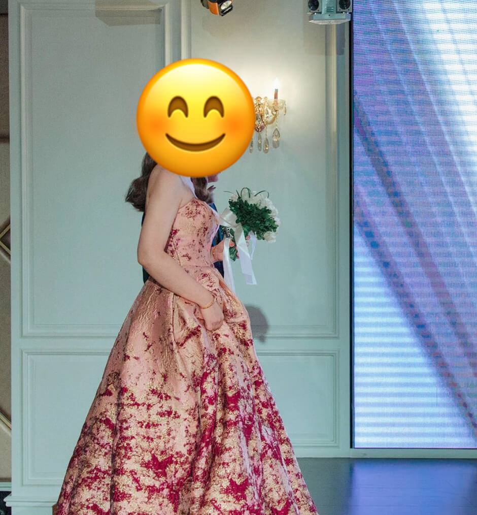 雷射減脂  減脂手術 贅肉