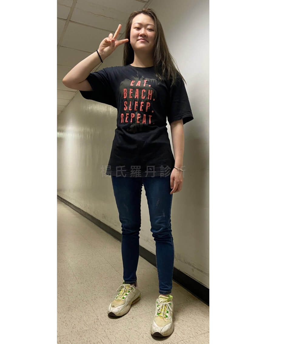 瘦身 肥胖 減肥