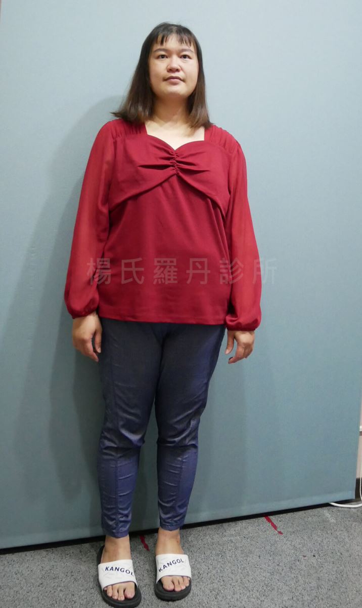 肥胖 減重 瘦身