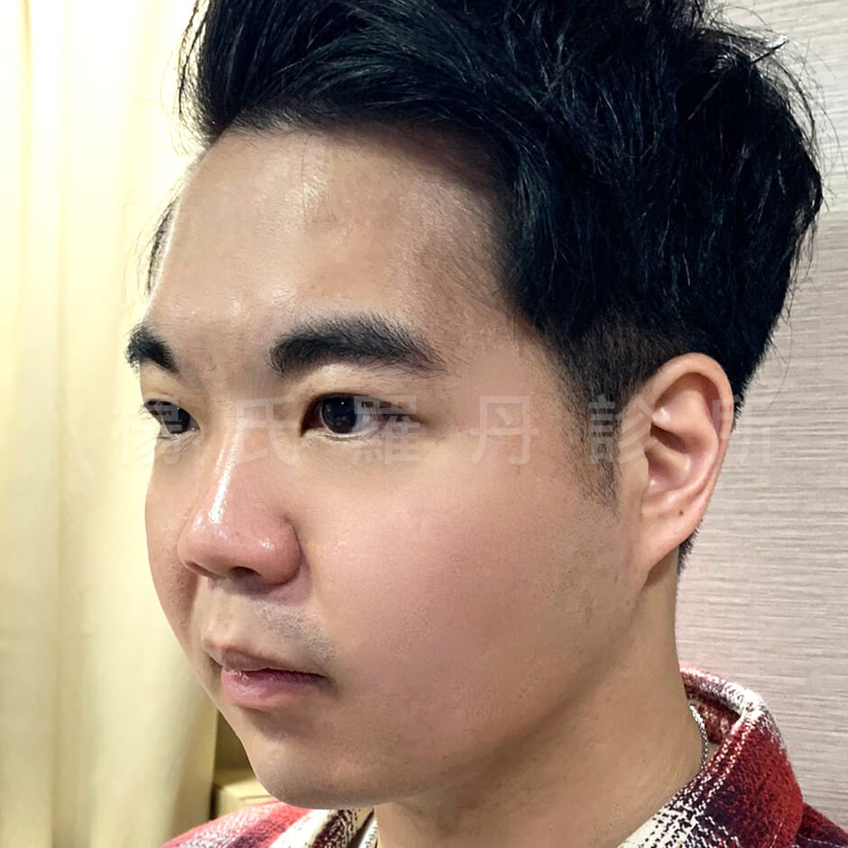 瘦臉 瘦下巴 小羊菌