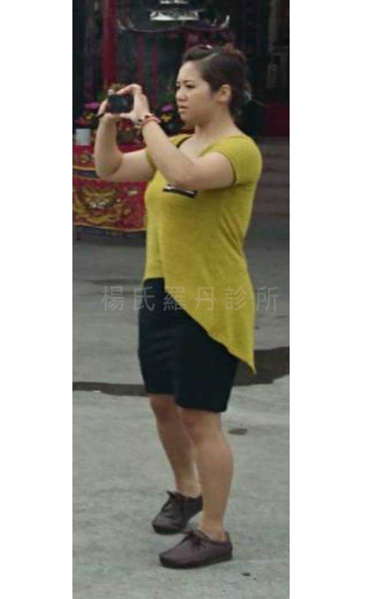 減肥 減肥效果 肥胖