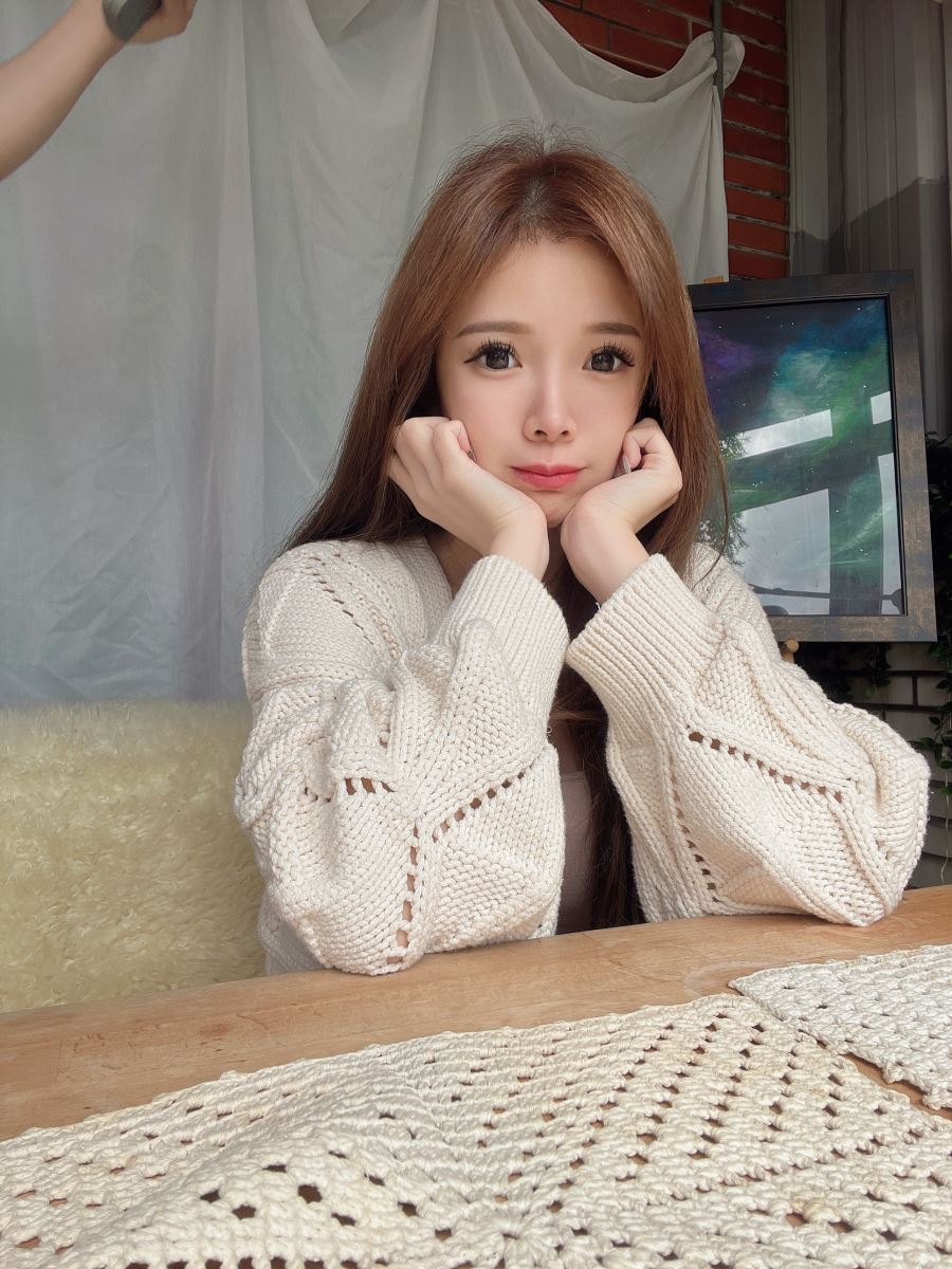 抽脂 腰腹抽脂 星蕾 雷射減脂