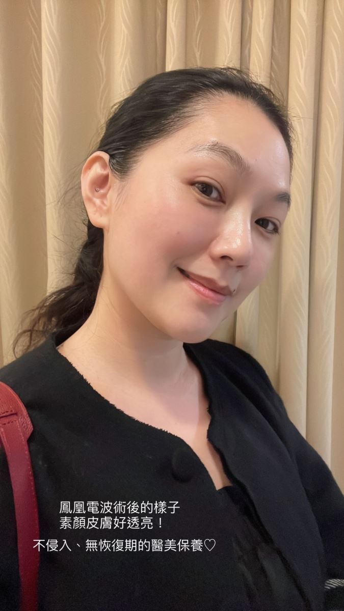 醫學美容 鳳凰電波 馬克媽媽