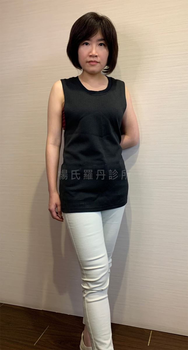 減重方法 減肥 減重 瘦身