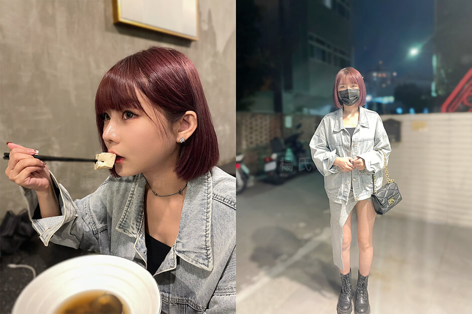 雷射減脂 抽脂 瘦手臂 雕塑