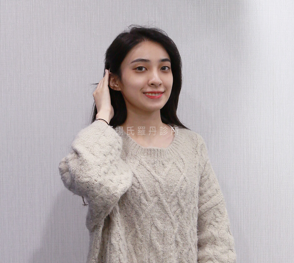 植髮 羽庭 美型植髮