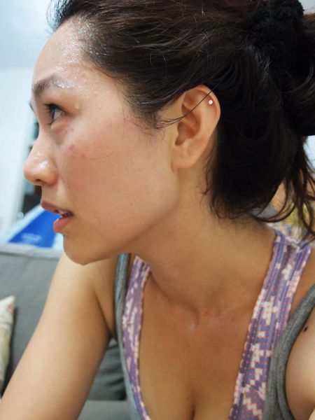 淨膚雷射 醫學美容 