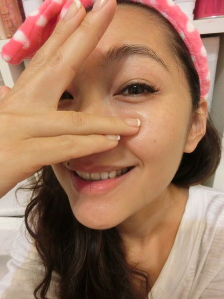 馬克媽媽 雷射除斑 除斑