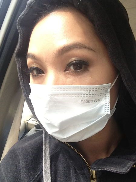 雷射除斑 淨膚雷射 除斑