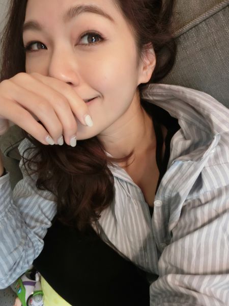 雷射除斑 馬克媽媽 除斑