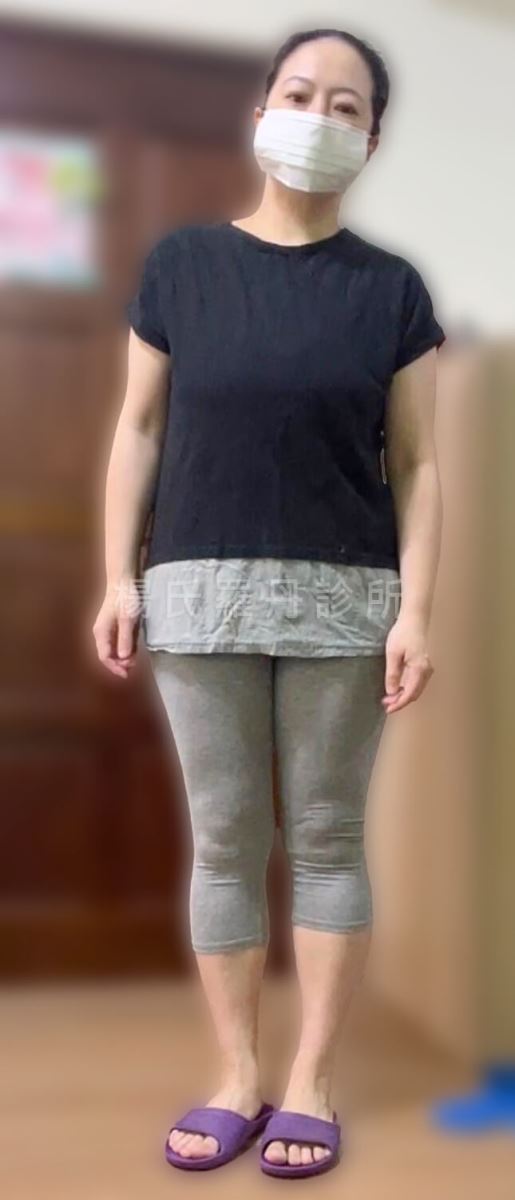 減肥 減重 減脂