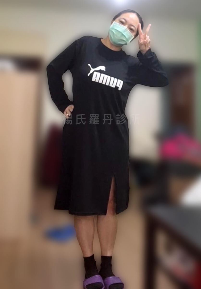 瘦身 減肥